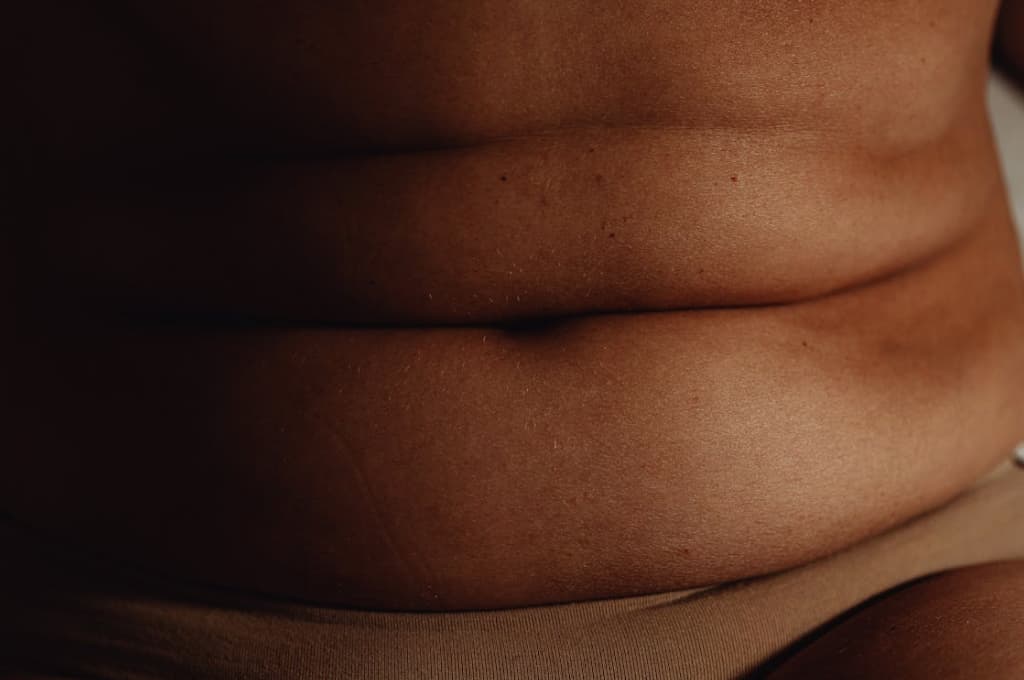 pacientes con obesidad